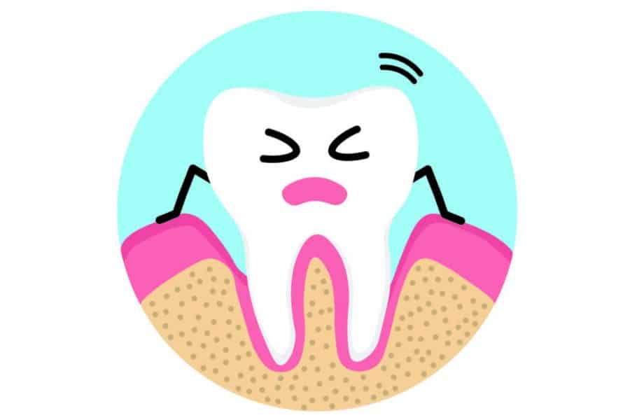 Thin or receded gums can cause tooth sensitivity and lead to root cavities.