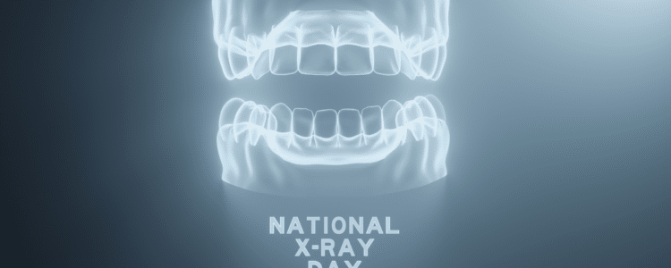Do Dental X-rays Show Gum Disease?