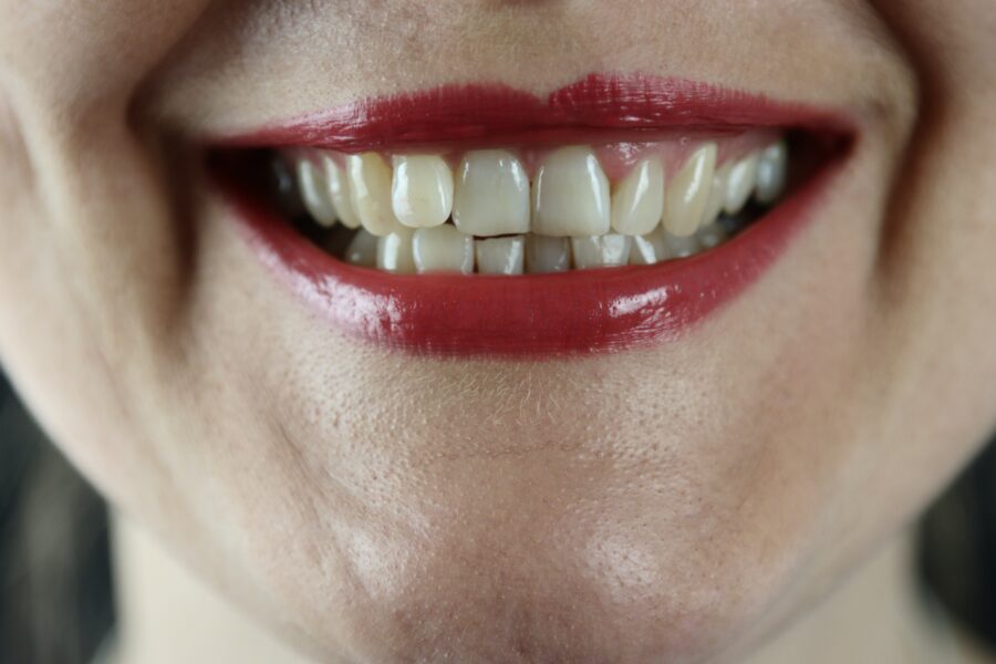 Smiling woman, teeth moving