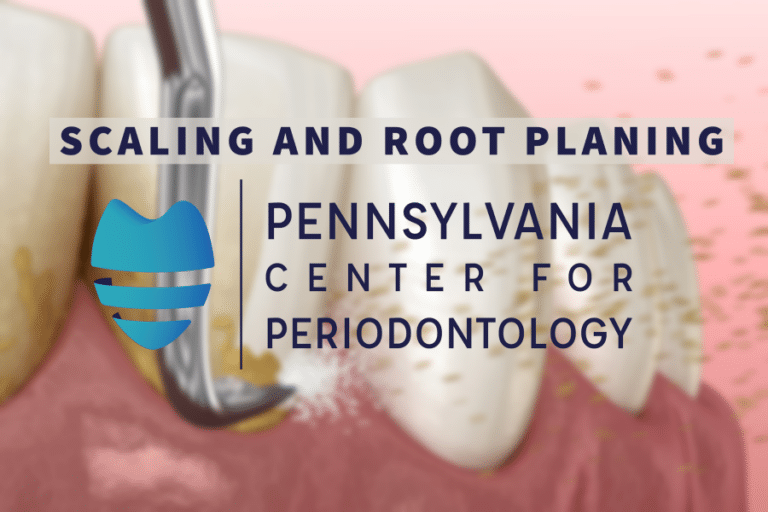 What is Scaling & Root Planing? Gum Disease Treatment